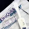 Herkese AIDS testi yapmak gerekir